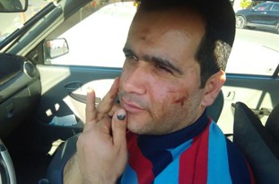 بازرس سازمان تاکسیرانی رشت مورد ضرب وشتم قرار گرفت + عکس