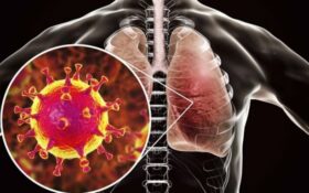 ویروس کرونا عامل ایجاد عفونت های حاد تنفسی است