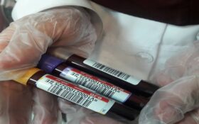 اهدای بیش از ۲۰ هزار واحد خون در گیلان