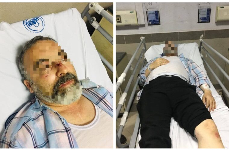ضرب و شتم شدید یک آمر به معروف در مسکن مهر رشت/ افراد خاطی دستگیر شدند